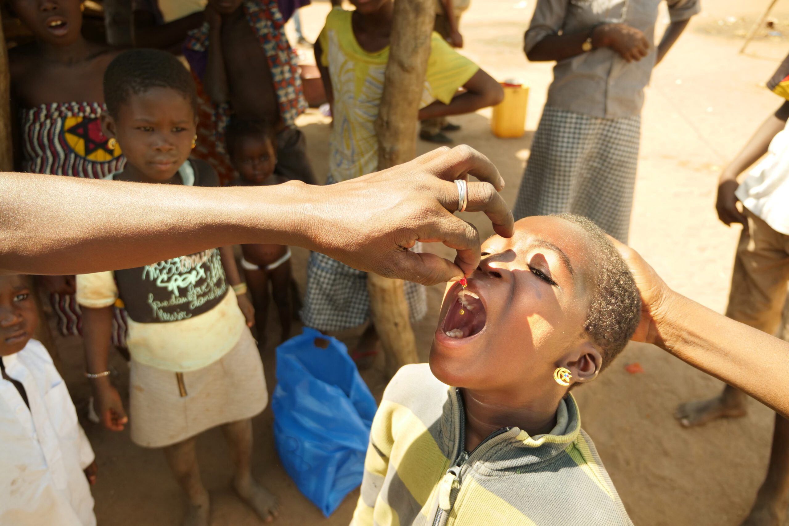 A child receives drops of vitamin A in Cote d'Ivoire.