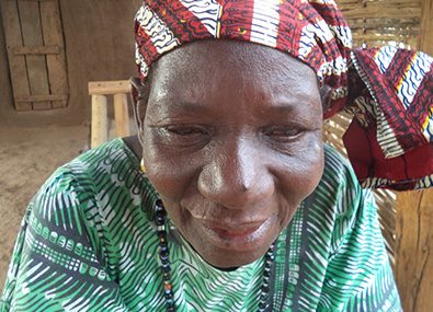 A woman from Mali who had trachoma wearing a head wrap.