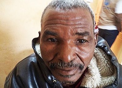 Older African man who had trachoma, looks at the camera .
