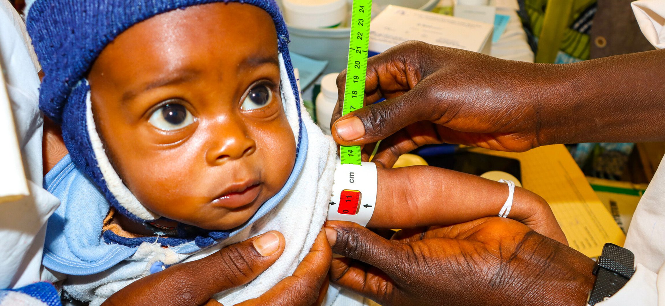 Infant being measured for nutritional assessment.