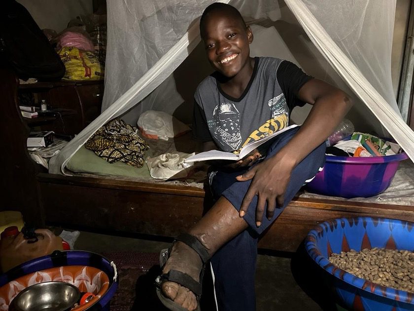 A teenage boy in Sierra Leone sits on a bed reading a book. His left leg is crossed over his right and his left leg and foot are swollen.