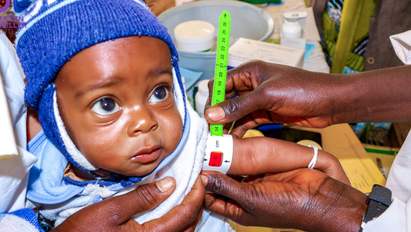 Child receiving arm measurement in health screening