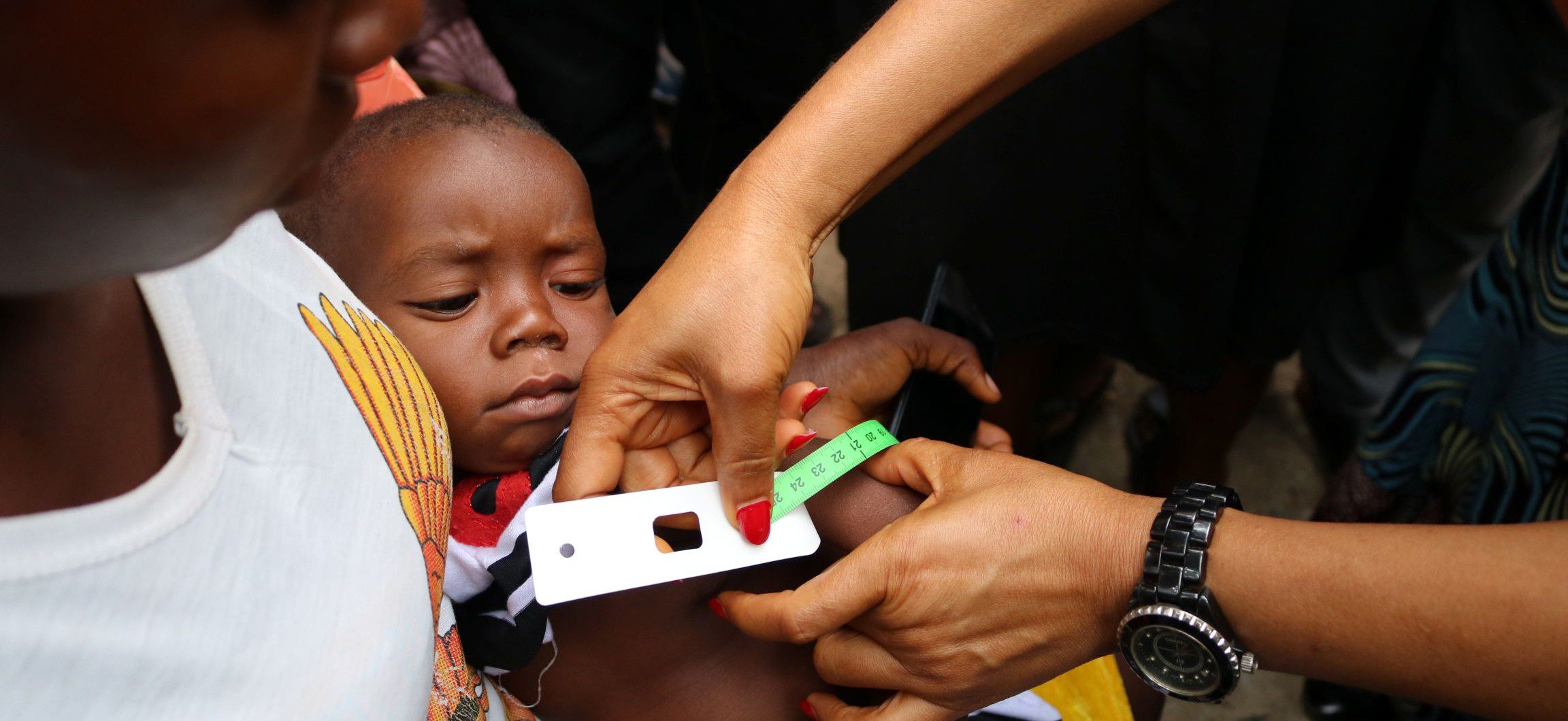 Child's arm being measured for malnutrition assessment in Nigeria