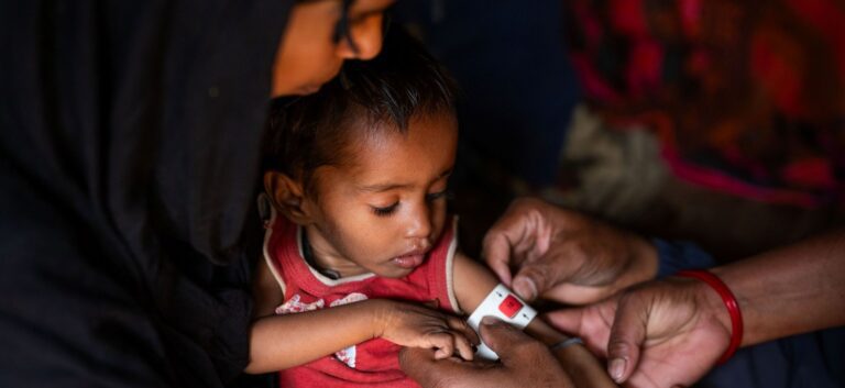A child in Nepal has his arm measured to screen for malnutrition.