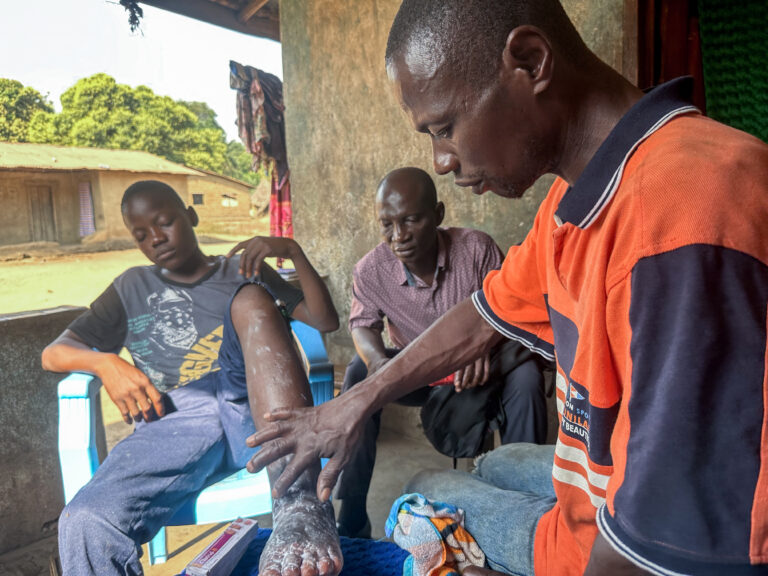 Man treating infected leg wound outdoors